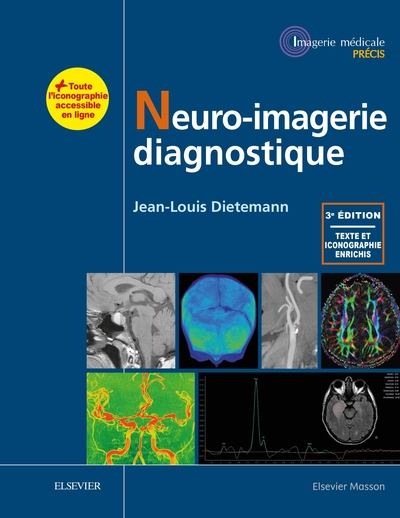 Neuro-imagerie diagnostique (9782294753947-front-cover)
