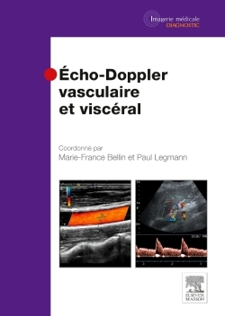 Echo-Doppler vasculaire et viscéral (9782294719479-front-cover)