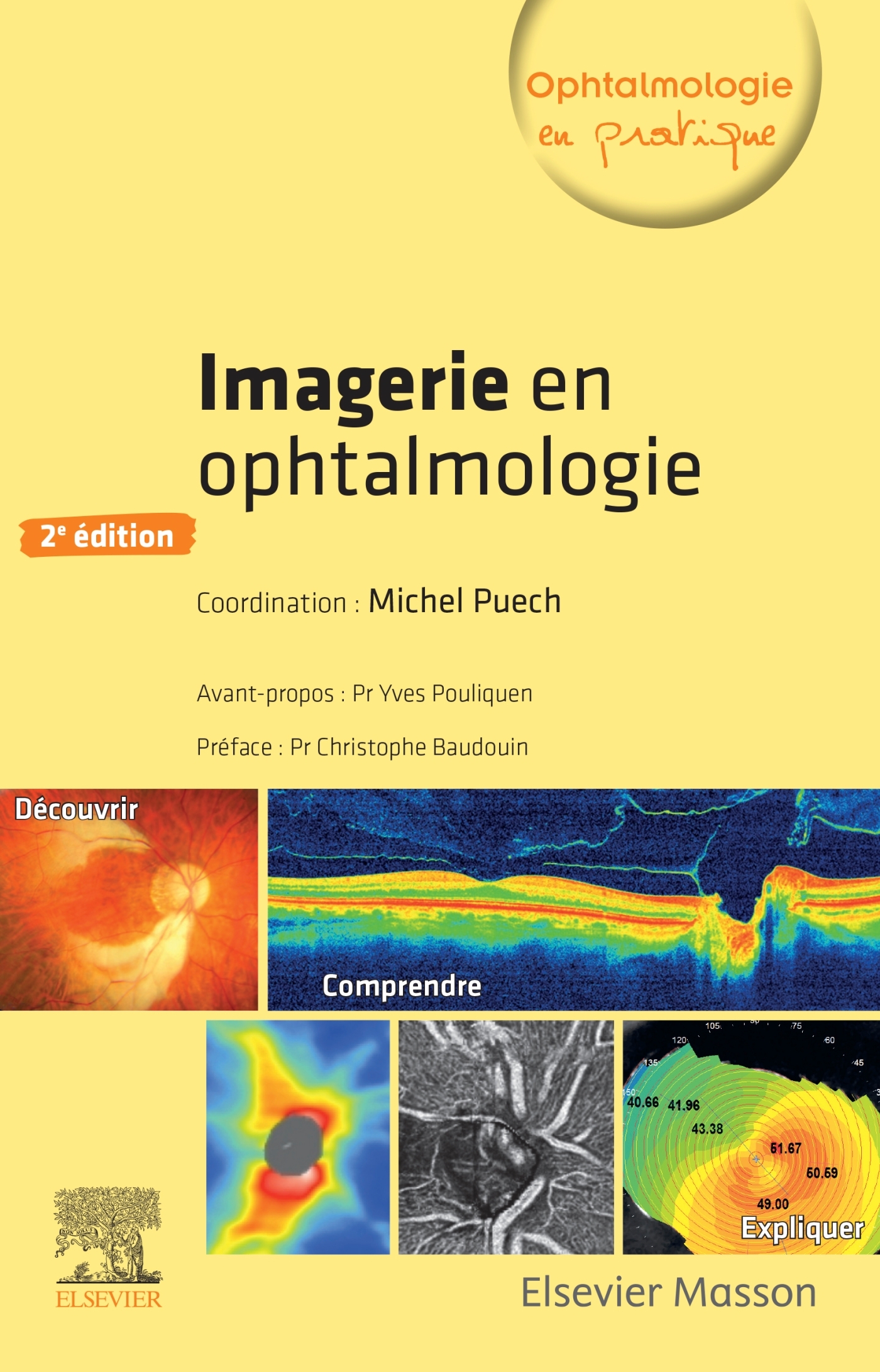 Imagerie en ophtalmologie (9782294760167-front-cover)