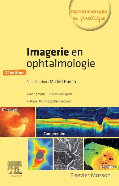 Imagerie en ophtalmologie (9782294760167-front-cover)