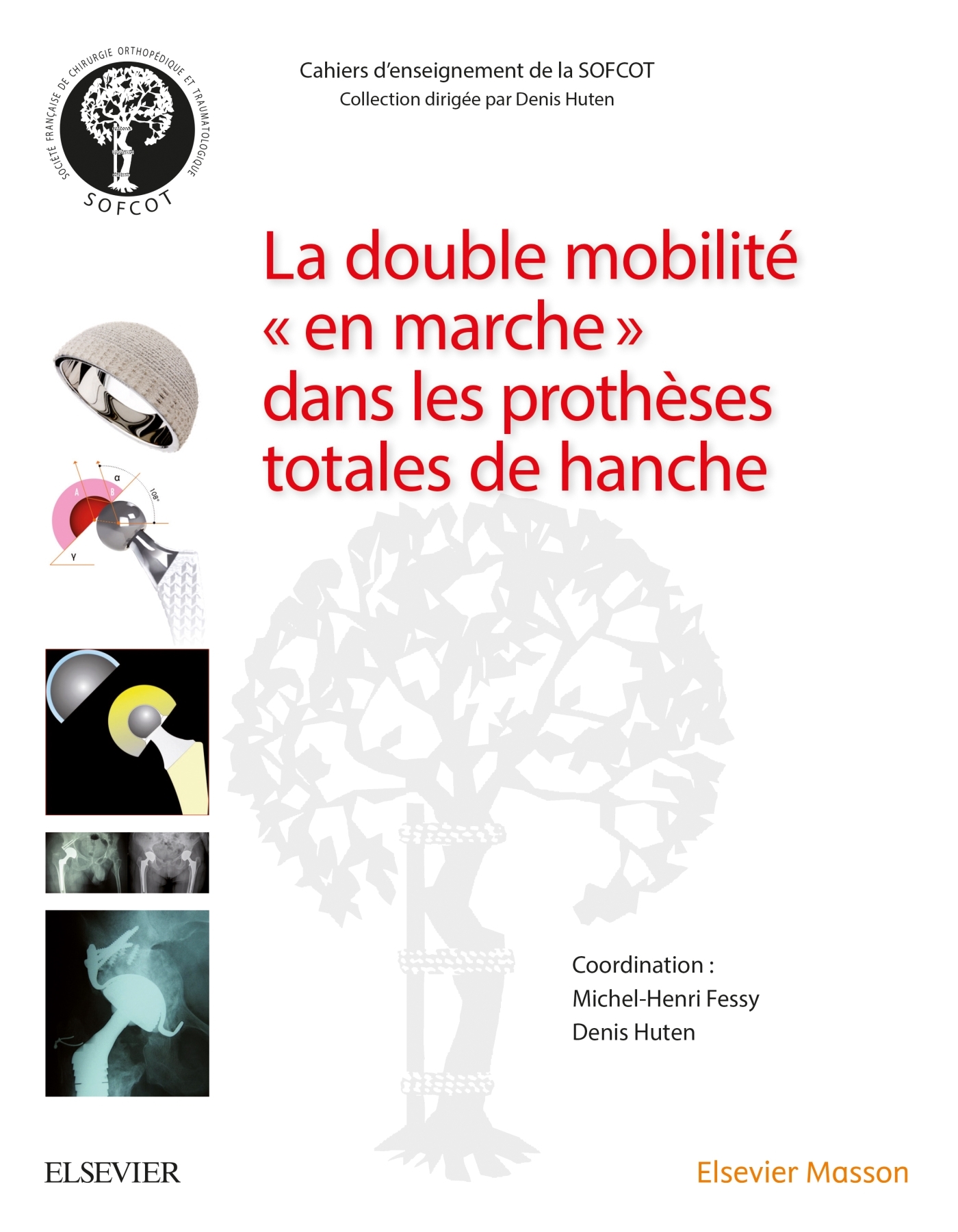 La double mobilité en marche dans les prothèses totales de hanche, 1ere Intention&Reprise (9782294760655-front-cover)