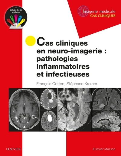 Cas cliniques en neuro-imagerie : pathologies inflammatoires et infectieuses, Path Inflammat Et Infectieuses (9782294758508-front-cover)