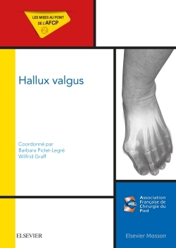 Hallux valgus, Mises au point de l'AFCP (9782294750663-front-cover)