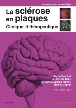 La sclérose en plaques - Clinique et thérapeutique (9782294750205-front-cover)