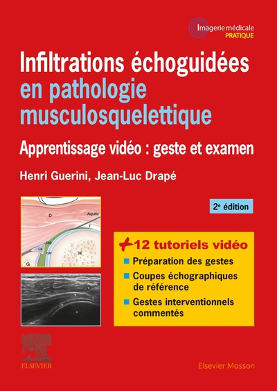 Infiltrations échoguidées en pathologie musculosquelettique, Apprentissage vidéo : geste et examen (9782294759987-front-cover)