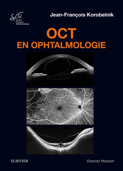 OCT en ophtalmologie (9782294760846-front-cover)