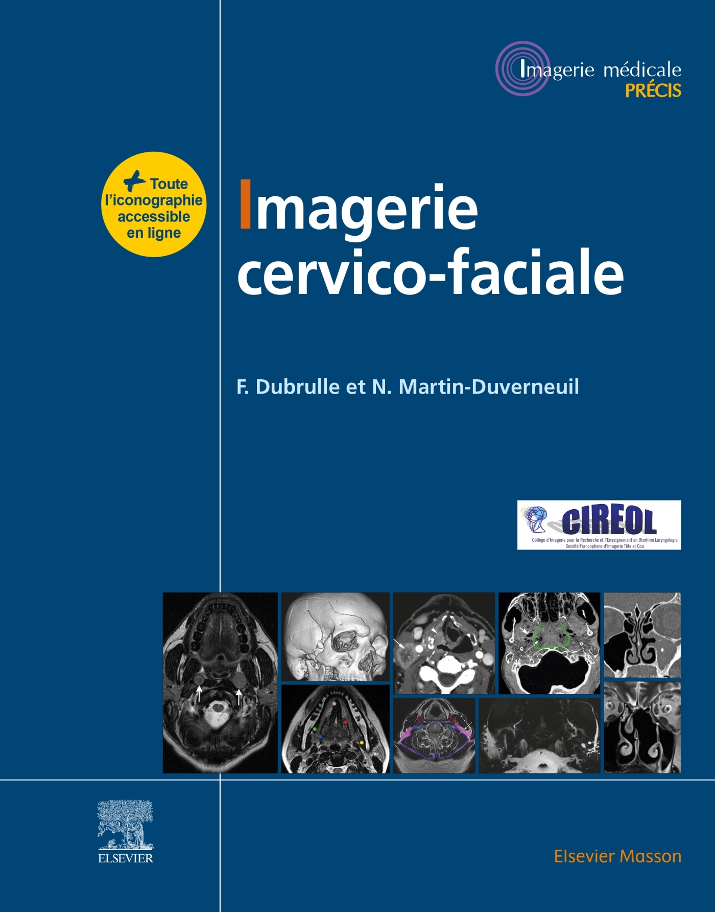 Imagerie cervicofaciale, Massif facial - Sinus - Voies aérodigestives supérieures - Pathologies cervicales - Espaces profonds (9782294775956-front-cover)