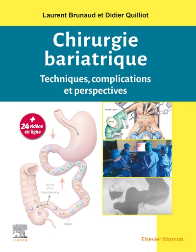 Chirurgie bariatrique, Techniques, complications et perspectives (9782294758799-front-cover)