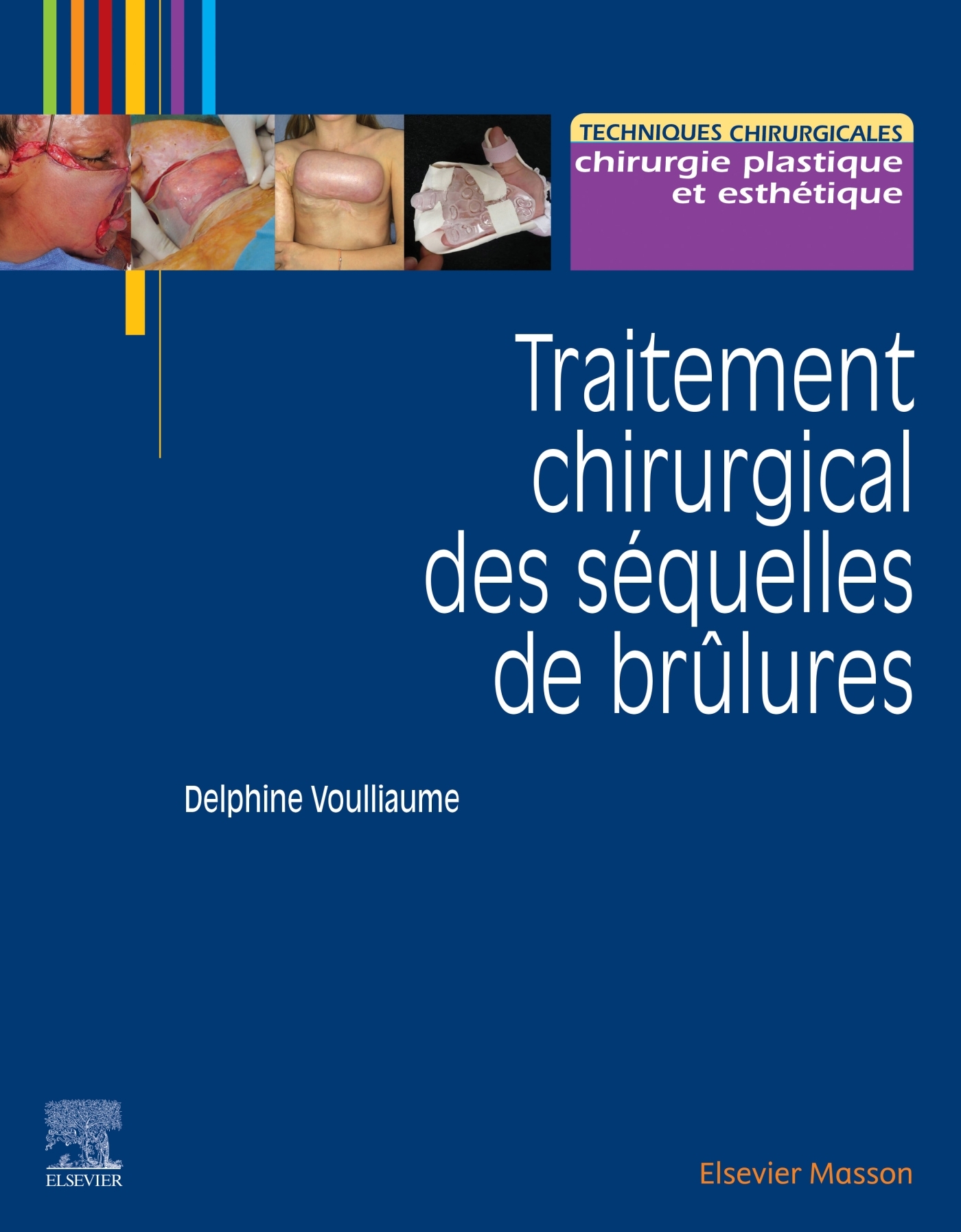 Traitement chirurgical des séquelles des brûlures (9782294763489-front-cover)