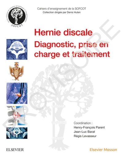 La hernie discale lombaire, Diagn,Prise En Ch Et Traitemt (9782294762864-front-cover)