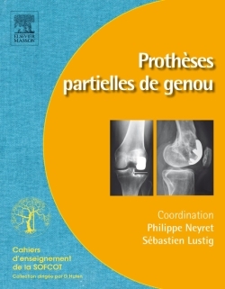 Prothèses partielles de genou (9782294714573-front-cover)
