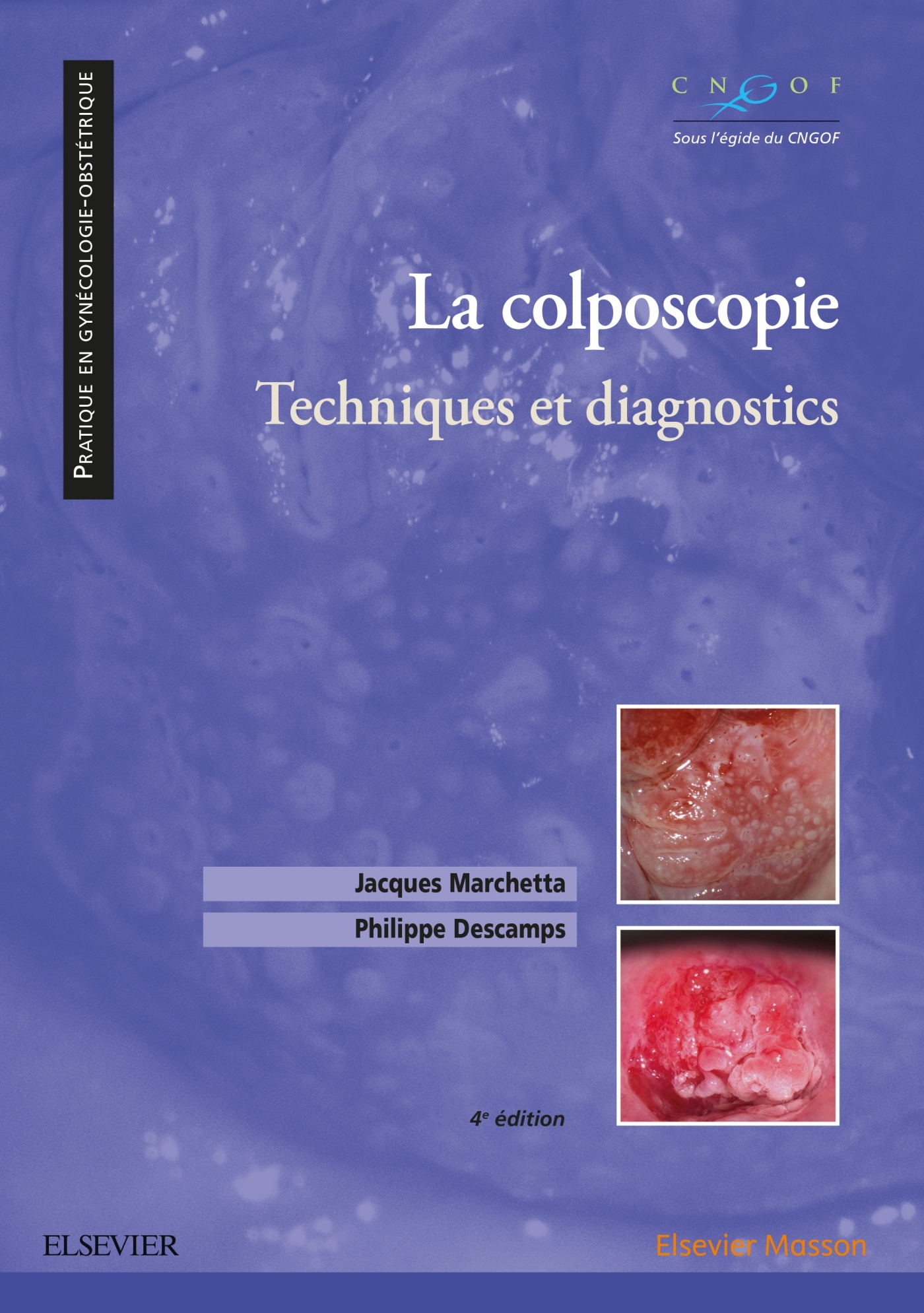 La colposcopie, Techniques et diagnostics (9782294759642-front-cover)