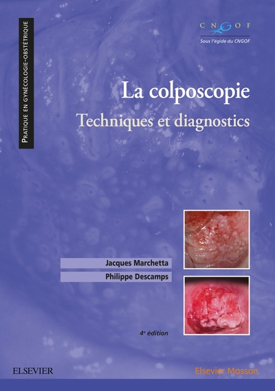 La colposcopie, Techniques et diagnostics (9782294759642-front-cover)