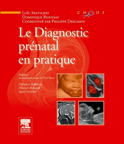 Le diagnostic prénatal en pratique (9782294709623-front-cover)