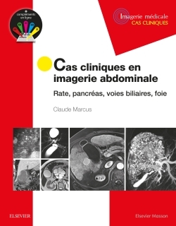 Cas cliniques en imagerie abdominale, Rate, pancréas, voies biliaires, foie (9782294753121-front-cover)
