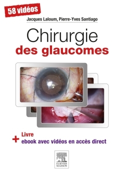 Chirurgie des glaucomes (9782294743757-front-cover)