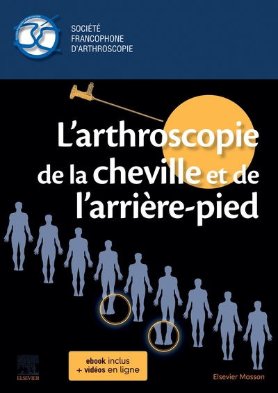 L'arthroscopie de la cheville et de l'arrière-pied (9782294766626-front-cover)