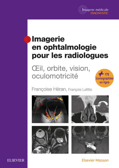 Imagerie en ophtalmologie pour les radiologues, Oeil, orbite, vision, oculomotricité (9782294754463-front-cover)
