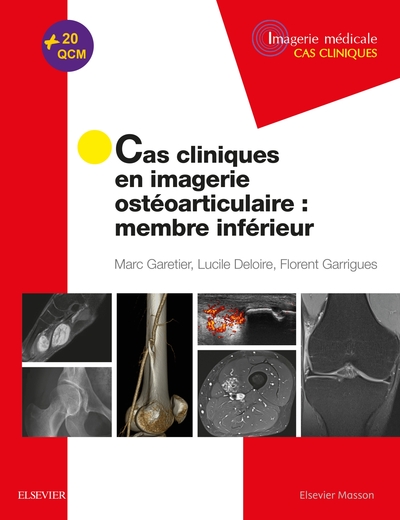 Cas cliniques en imagerie ostéoarticulaire : membre inférieur, Membre Inferieur (9782294759666-front-cover)