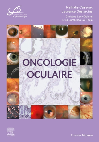 Oncologie oculaire, Rapport SFO 2022 (9782294765940-front-cover)
