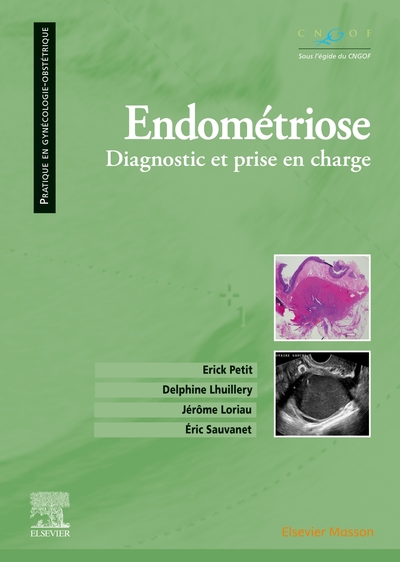 Endométriose, Diagnostic et prise en charge (9782294767814-front-cover)