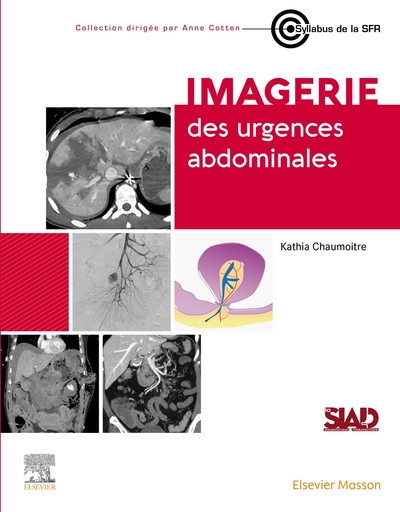 Imagerie des urgences abdominales (9782294788499-front-cover)
