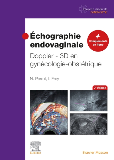 Échographie endovaginale Doppler - 3D, en gynécologie-obstétrique (9782294775000-front-cover)
