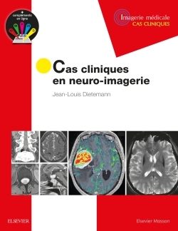 Cas cliniques en neuro-imagerie, Pathologies tumorales (9782294751998-front-cover)