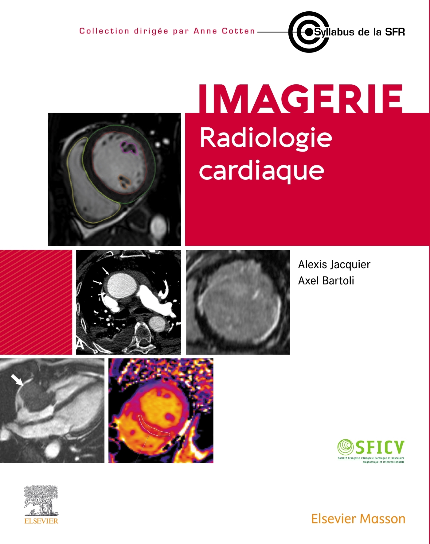 Radiologie cardiaque (9782294788482-front-cover)