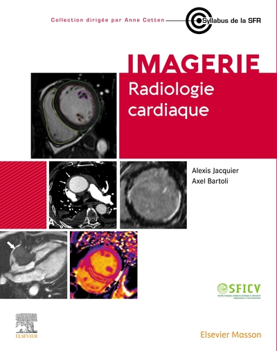 Radiologie cardiaque (9782294788482-front-cover)