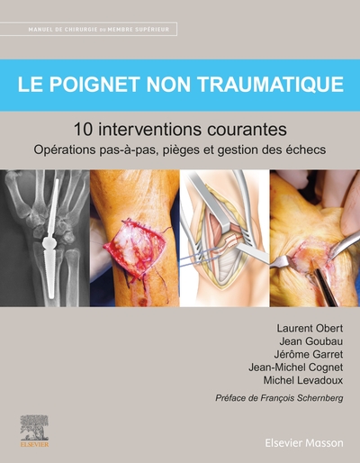 Le poignet non traumatique 10 interventions courantes, Manuel de chirurgie du membre supérieur (9782294777424-front-cover)