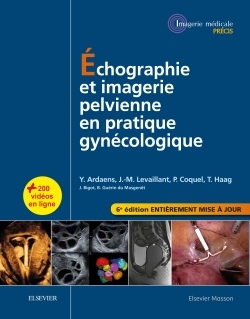 Échographie et imagerie pelvienne en pratique gynécologique (9782294746475-front-cover)