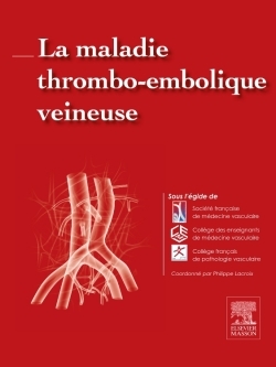 La maladie thrombo-embolique veineuse (9782294744891-front-cover)