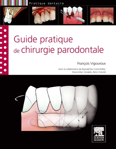 Guide pratique de chirurgie parodontale (9782294714467-front-cover)