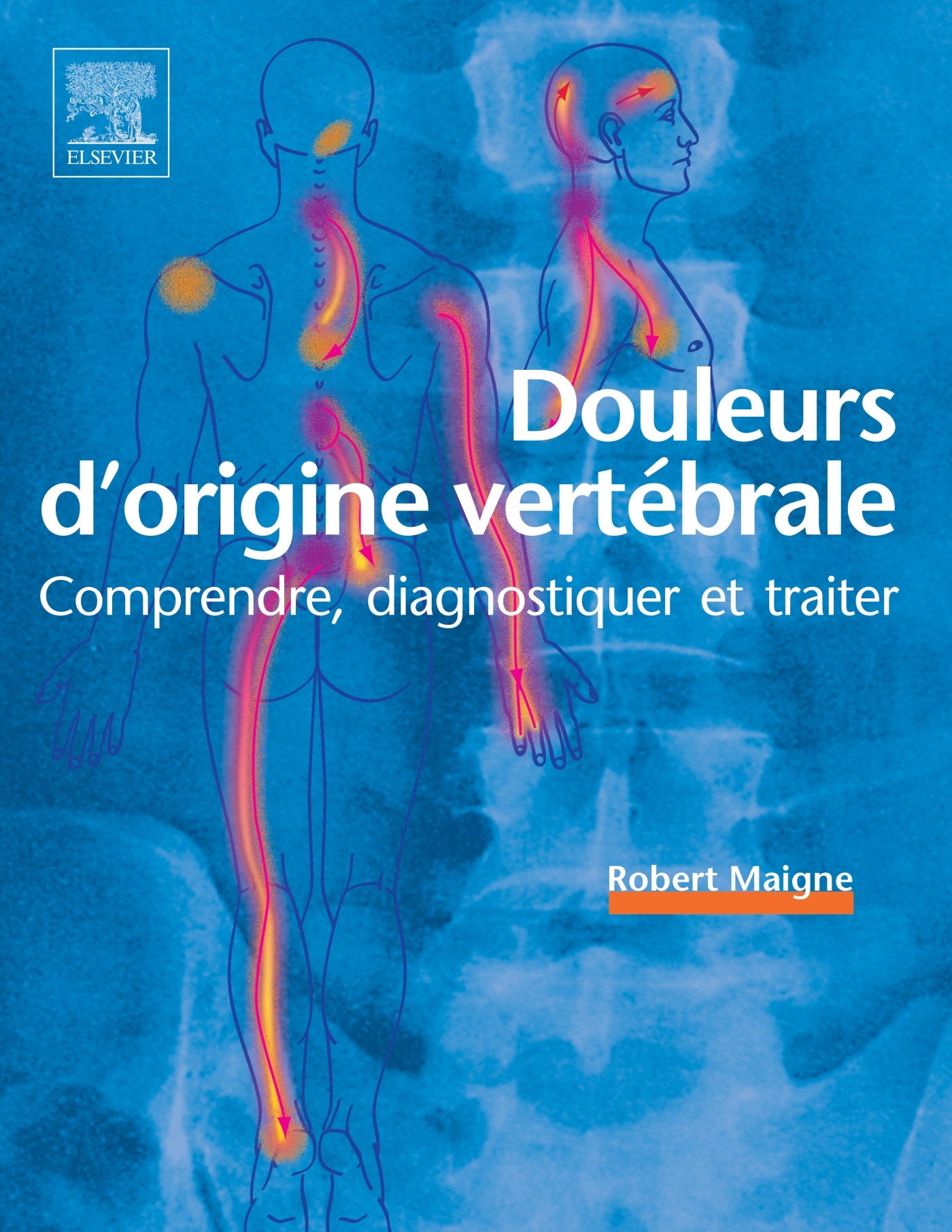 Douleurs d'origine vertébrale, Comprendre, diagnostiquer et traiter (9782294772825-front-cover)