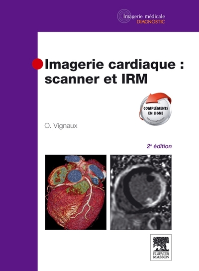 Imagerie cardiaque : scanner et IRM (9782294712258-front-cover)