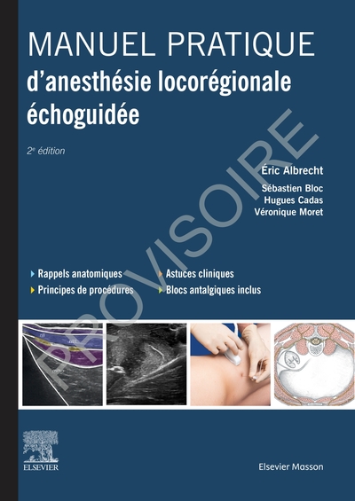 Manuel pratique d'anesthésie locorégionale échoguidée (9782294760136-front-cover)