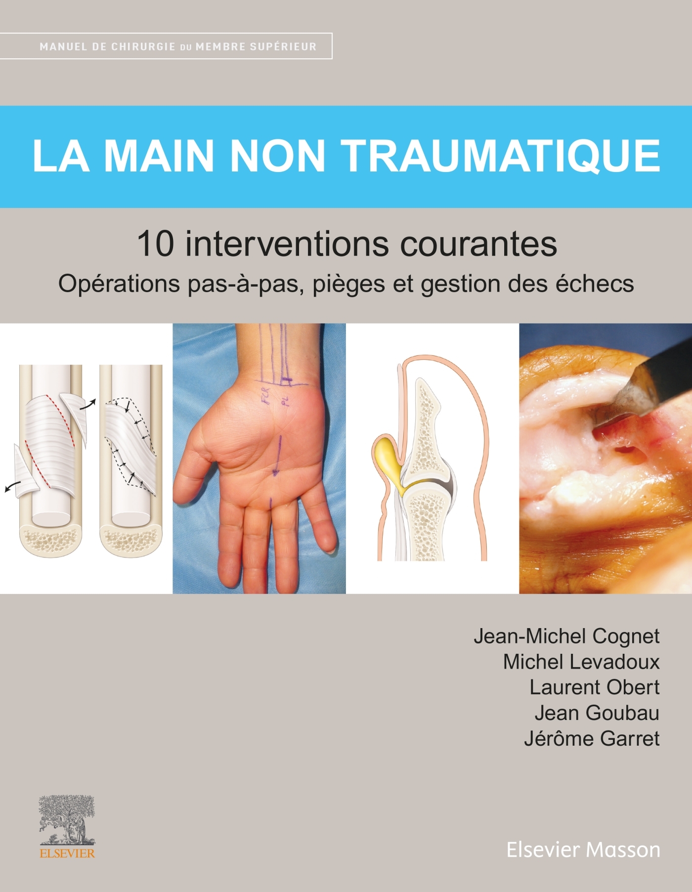 La main non traumatique 10 interventions courantes, Manuel de chirurgie du membre supérieur (9782294769238-front-cover)