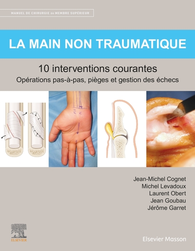 La main non traumatique 10 interventions courantes, Manuel de chirurgie du membre supérieur (9782294769238-front-cover)