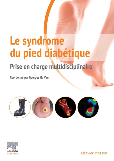 Le syndrome du pied diabétique, Prise en charge multidisciplinaire (9782294762437-front-cover)
