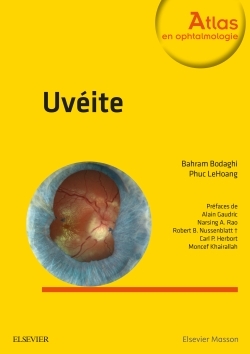 Uvéite (9782294744686-front-cover)