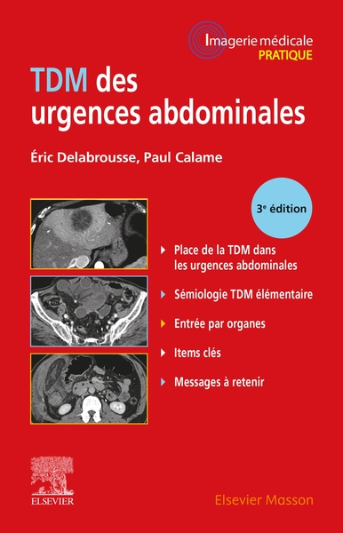 TDM des urgences abdominales (9782294770852-front-cover)