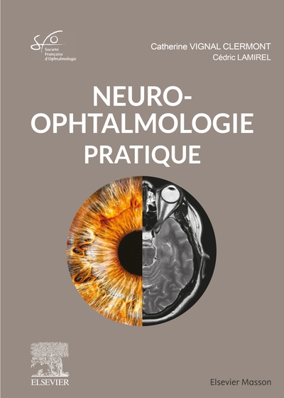Neuro-ophtalmologie pratique, Rapport SFO 2020 (9782294763830-front-cover)