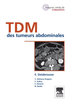 TDM des tumeurs abdominales (9782294714863-front-cover)