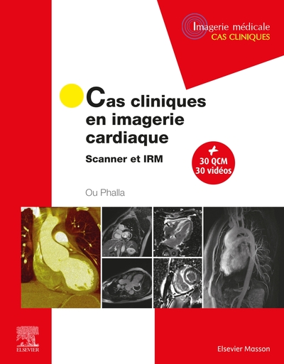 Cas cliniques en imagerie cardiaque, Scanner et IRM (9782294773938-front-cover)