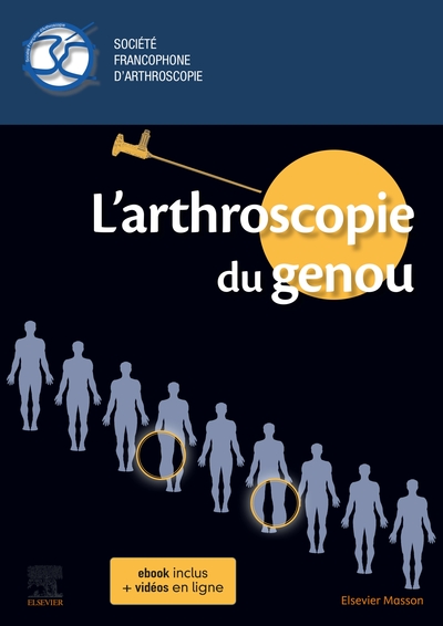 L'arthroscopie du genou (9782294766657-front-cover)