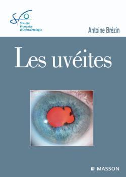 Les uvéites, Rapport SFO 2010 (9782294711077-front-cover)