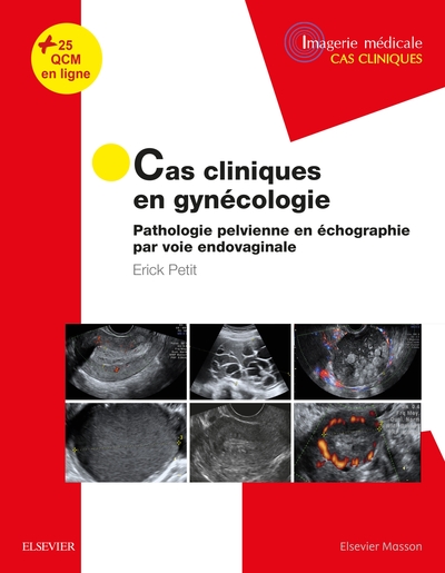 Cas cliniques en imagerie : gynécologie, Pathologie pelvienne en échographie par voie endovaginale (9782294755514-front-cover)