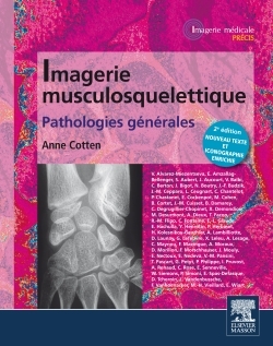 Imagerie musculosquelettique : pathologies générales (9782294719240-front-cover)