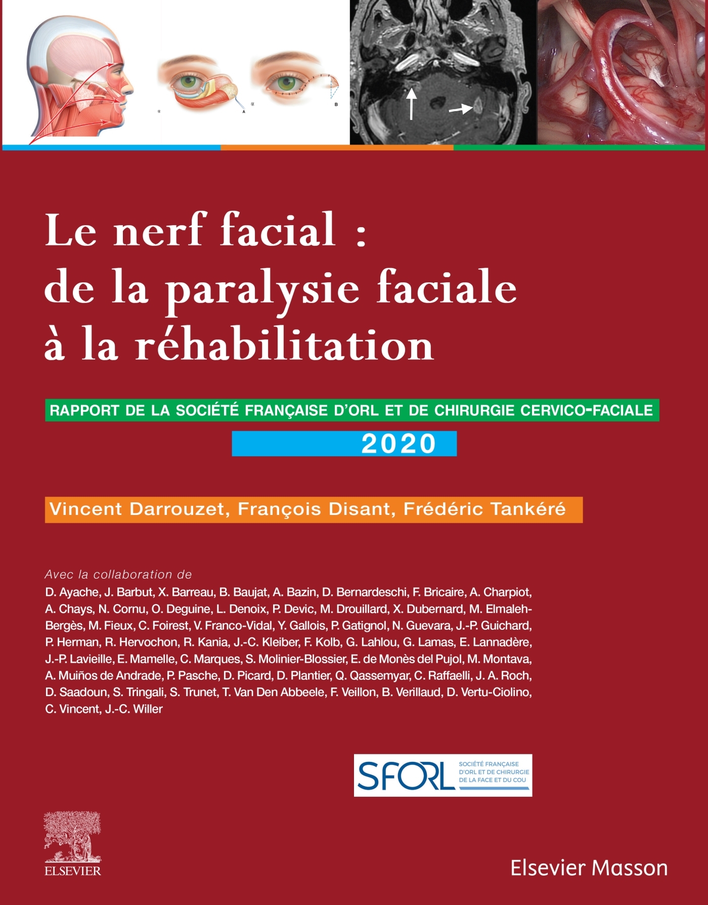 Le nerf facial : de la paralysie faciale à la réhabilitation, Rapport SFORL 2020 (9782294774447-front-cover)